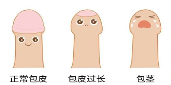 总榜揭晓:南通看包皮过长哪家医院好!