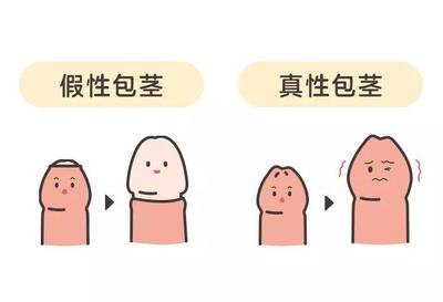 男性健康：南通看男科正规的医院“男科正规”南通治疗包皮包茎什么医院好？