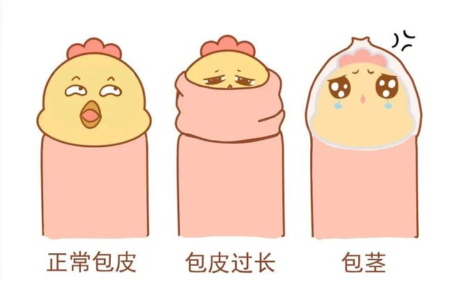 强势推荐：南通看包皮问题医院“总榜靠前公开”南通做包皮手术好的医院！