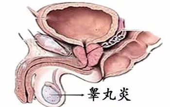 近期热点：南通正规男科医院“聚焦男科”南通治疗睾丸炎去哪家医院好？