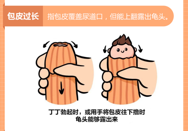 男性健康：南通男科排名好的医院“前十公开”南通看包皮过长到哪家医院好？