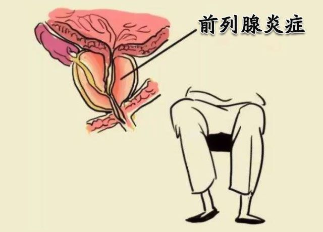 健康指南：南通前列腺炎治疗医院“实时发布”南通哪家医院治疗前列腺炎比较好？